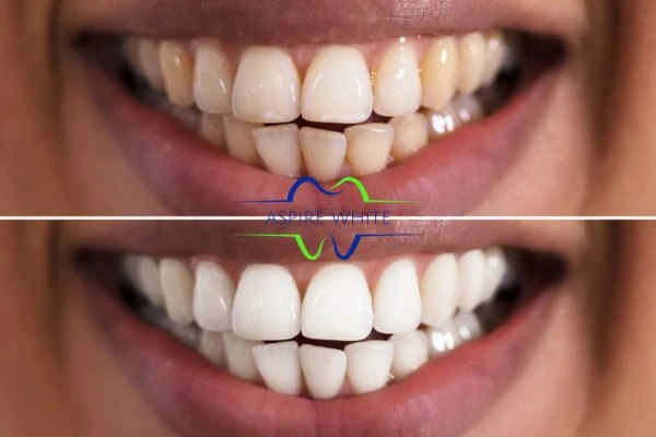 Aspire White customer before and after Burnley results.