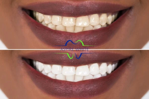 Side-by-side comparison showing before and after results of a cosmetic treatment Burnley