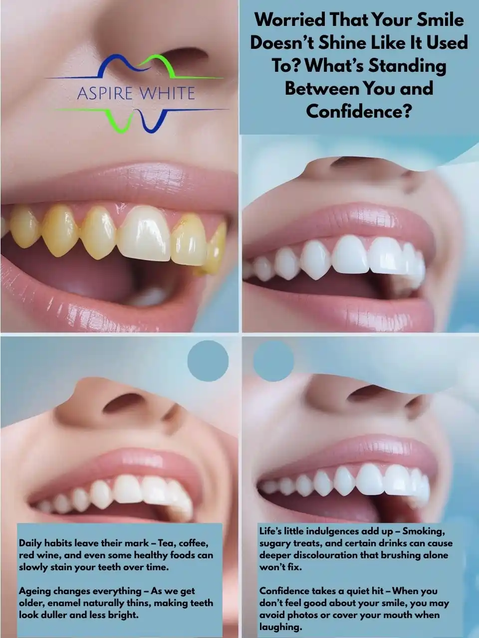 Worried That Your Smile Doesn’t Shine Like It Used To What’s Standing Between You and Confidence Burnley